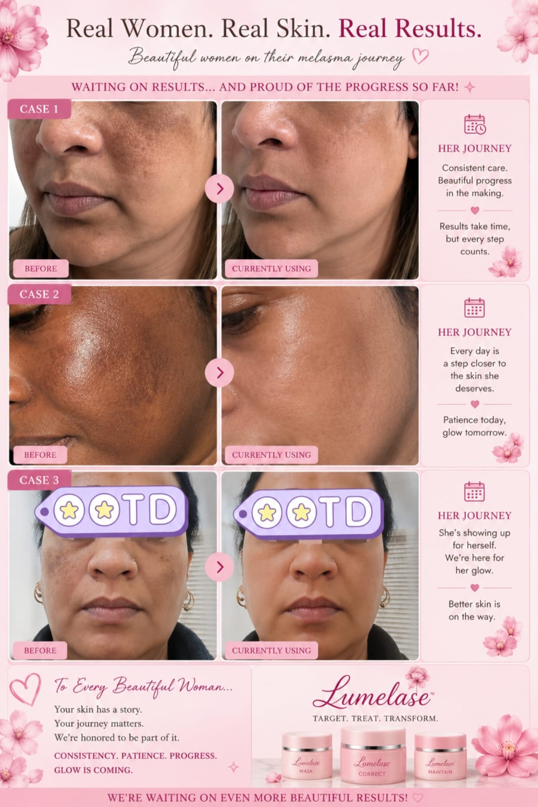 LumeLase customer progress journeys